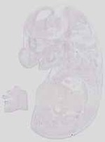 EMAGE:19035