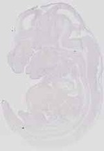 EMAGE:19035