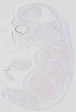 EMAGE:19036