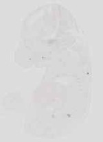 EMAGE:19039