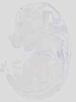 EMAGE:19039