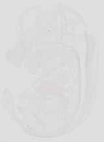 EMAGE:19043