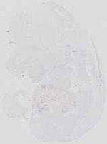 EMAGE:19047