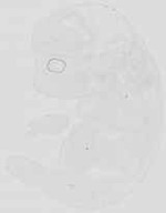 EMAGE:19061