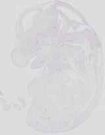 EMAGE:19061