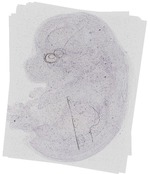EMAGE:19061