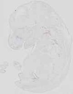 EMAGE:19065