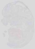 EMAGE:19069