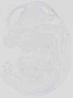 EMAGE:19073