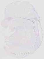 EMAGE:19088
