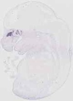 EMAGE:19127