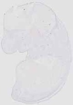 EMAGE:19127