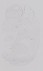 EMAGE:19215