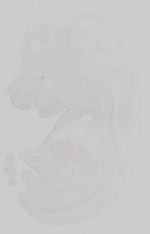 EMAGE:19215