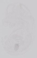 EMAGE:19215