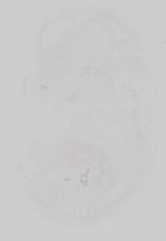 EMAGE:19215