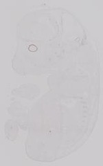 EMAGE:19215