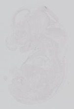 EMAGE:19217