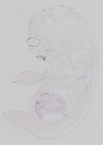 EMAGE:19228