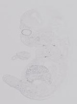 EMAGE:19228