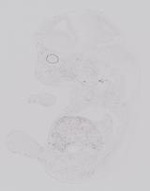 EMAGE:19228