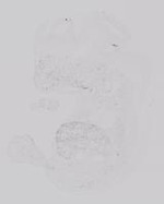 EMAGE:19228