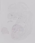 EMAGE:19228