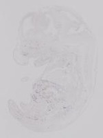 EMAGE:19228