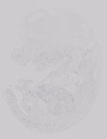 EMAGE:19228