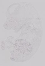 EMAGE:19228