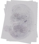 EMAGE:19228