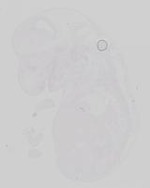 EMAGE:19237
