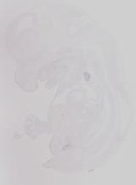 EMAGE:19237