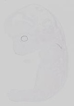 EMAGE:19237
