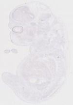 EMAGE:19247