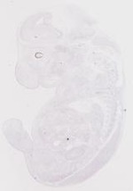 EMAGE:19247