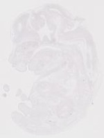 EMAGE:19247