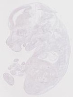 EMAGE:19247
