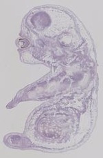 EMAGE:19248