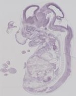EMAGE:19248