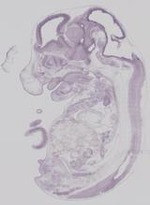 EMAGE:19248
