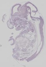 EMAGE:19251