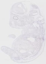 EMAGE:19256