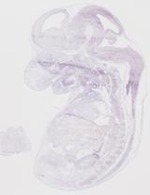 EMAGE:19256