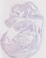 EMAGE:19256
