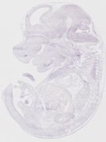 EMAGE:19256