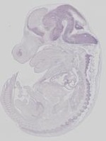 EMAGE:19258