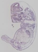 EMAGE:19259