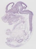 EMAGE:19261