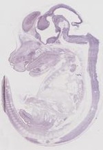 EMAGE:19261